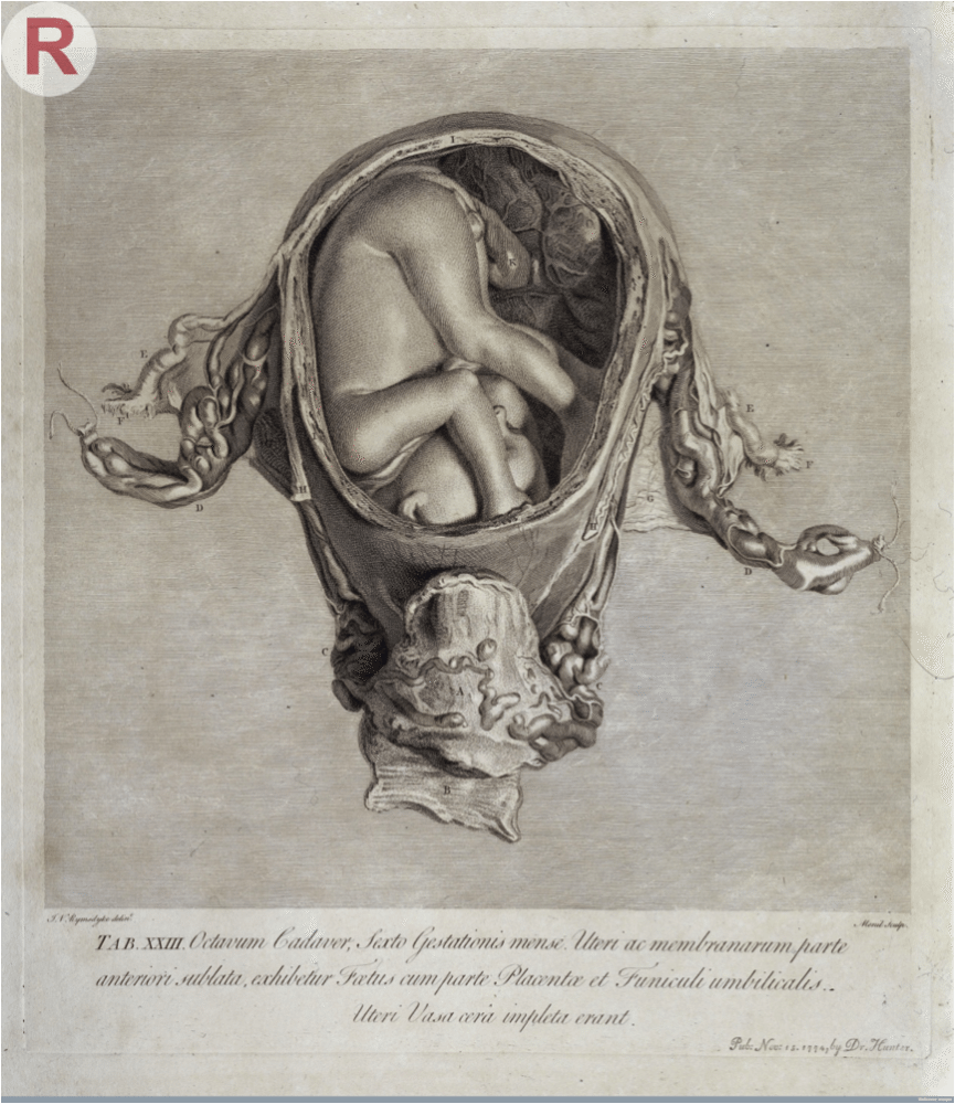 懷孕六個月大的人類子宮，取自杭特的《人類妊娠子宮解剖圖集》。(本書頁33) 出處網址：http://wellcomeimages.org/indexplus/image/L0032851.html 